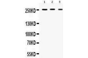 Western blot analysis of Scn1a expression in rat brain extract (lane 1), mouse brain extract (lane 2) and U87 whole cell lysates (lane 4).