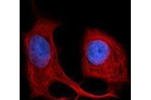 Immunofluorescence (IF) image for anti-Keratin 18 (KRT18) antibody (Alexa Fluor 594) (ABIN2656840) (Cytokeratin 18 Antikörper  (Alexa Fluor 594))