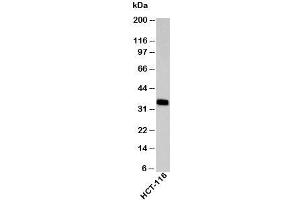 Western blot testing of human samples with EpCAM antibody at 2ug/ml. (EpCAM Antikörper  (C-Term))
