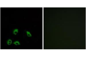 Immunofluorescence analysis of MCF7 cells, using GPR103 Antibody. (QRFPR Antikörper  (AA 271-320))