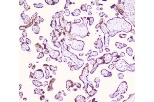 IHC analysis of LRTOMT using anti-LRTOMT antibody (ABIN7602986). (Leucine Rich Transmembrane and 0-Methyltransferase Domain Containing (LRTOMT) (Middle Region) Antikörper)
