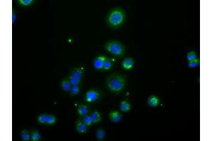 Image no. 3 for anti-Acetyl-CoA Acetyltransferase 2 (ACAT2) antibody (ABIN1496397) (ACAT2 Antikörper)