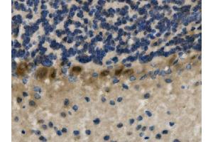 IHC analysis of LHX1 using anti-LHX1 antibody (ABIN7599263). (LHX1 Antikörper  (AA 1-317))
