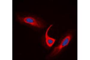 Immunofluorescent analysis of ACOT4 staining in A549 cells. (ACOT4 Antikörper  (C-Term))