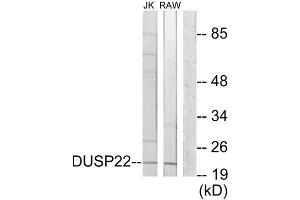 Western Blotting (WB) image for anti-Dual Specificity Phosphatase 22 (DUSP22) (Internal Region) antibody (ABIN1850000) (DUSP22 Antikörper  (Internal Region))