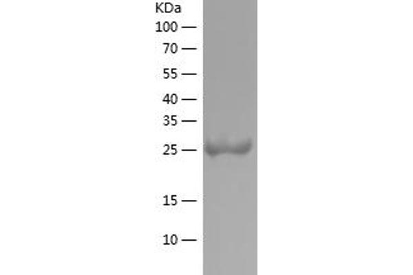tau Protein (AA 200-380) (His tag)