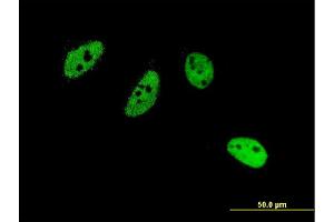 Immunofluorescence of monoclonal antibody to CREM on HeLa cell. (CREM Antikörper  (AA 201-300))
