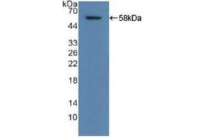 Figure. (ALDH1A1 Antikörper  (AA 2-501))