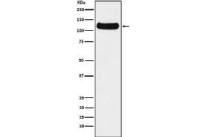 Western blot analysis of DDB1 expression in HeLa cell lysate.