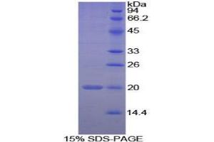 SDS-PAGE analysis of Human PPIF Protein. (PPIF Protein)