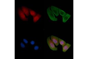 ABIN6255653 and ABIN6268976 staining Hela cells(30 min of UV treatment) by IF/ICC. (Cyclin D2 Antikörper  (pThr280))