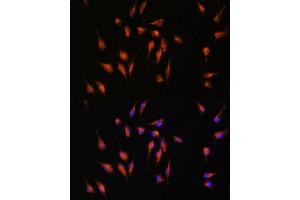 Immunofluorescence analysis of L929 cells using MMP9 antibody (ABIN6131951, ABIN6143920, ABIN6143923 and ABIN6213777) at dilution of 1:100.