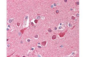 Anti-TF / Transferrin antibody IHC of human brain, cortex. (Transferrin Antikörper)