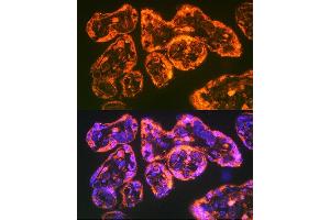 Immunofluorescence analysis of Human placenta using Integrin alpha 5 (ITG/CD49e) antibody (ABIN6131552, ABIN6142564, ABIN6142565 and ABIN6221799) at dilution of 1:100. (ITGA5 Antikörper  (AA 750-1000))