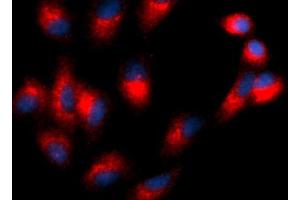 Immunofluorescence (IF) image for anti-Tetraspanin 26 (TSPAN26) (AA 112-241) antibody (PE) (ABIN5566698) (CD37 Antikörper  (AA 112-241) (PE))