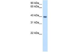 WB Suggested Anti-ITGB1BP2 Antibody Titration:  2. (ITGB1BP2 Antikörper  (N-Term))