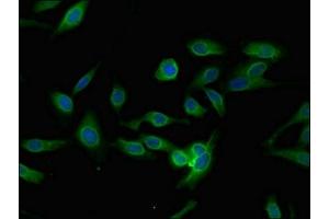 Immunofluorescent analysis of Hela cells using ABIN7163658 at dilution of 1:100 and Alexa Fluor 488-congugated AffiniPure Goat Anti-Rabbit IgG(H+L) (PLEKHO1 Antikörper  (AA 143-404))