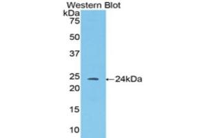 Western Blotting (WB) image for anti-Angiopoietin 1 (ANGPT1) (AA 35-231) antibody (ABIN1857990) (Angiopoietin 1 Antikörper  (AA 35-231))