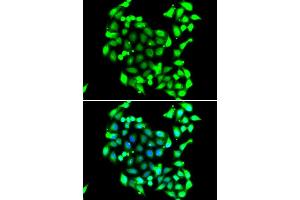 Immunofluorescence analysis of A549 cell using GTF2H3 antibody. (GTF2H3 Antikörper)