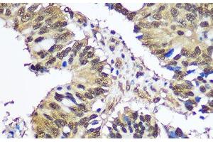 Immunohistochemistry (Paraffin-embedded Sections) (IHC (p)) image for anti-Ubiquitin-Like Modifier Activating Enzyme 1 (UBA1) antibody (ABIN7256058)