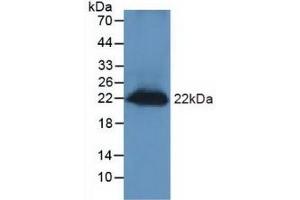 Detection of REG3g in Mouse Testis Tissue using Polyclonal Antibody to Regenerating Islet Derived Protein 3 Gamma (REG3g)