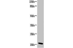 Western blot All lanes: CCDC32 antibody at 2 μg/mL + HL60 whole cell lysate Secondary Goat polyclonal to rabbit IgG at 1/10000 dilution Predicted band size: 21, 22, 16 kDa Observed band size: 21 kDa (C15ORF57 Antikörper  (AA 1-185))