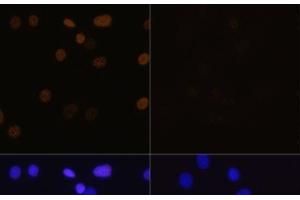 Immunofluorescence analysis of C6 cells using Acetyl-Histone H4-K16 Polyclonal Antibody at dilution of 1:100. (Histone H4 Antikörper  (acLys16))