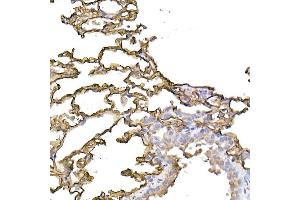 Immunohistochemistry of paraffin-embedded human tonsil using ICAM-1/CD54 Rabbit pAb (ABIN6129231, ABIN6142118, ABIN6142120 and ABIN6221235) at dilution of 1:100 (40x lens). (ICAM1 Antikörper  (AA 250-480))
