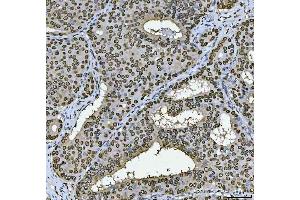 IHC analysis of PC4/SUB1 using anti-PC4/SUB1 antibody (ABIN7602185). (SUB1 Antikörper  (AA 62-127))