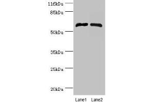 Western blot All lanes: CYP4F11 antibody at 2 μg/mL Lane 1: Mouse liver tissue Lane 2: Mouse kidney tissue Secondary Goat polyclonal to rabbit IgG at 1/10000 dilution Predicted band size: 61 kDa Observed band size: 61 kDa (CYP4F11 Antikörper  (AA 38-524))