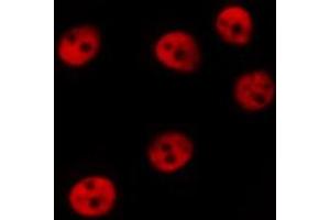 Immunofluorescence (fixed cells) (IF/ICC) image for anti-Microphthalmia-Associated Transcription Factor (MITF) (pSer180), (pSer73) antibody (ABIN6255037)