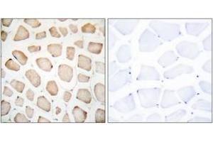 Immunohistochemistry analysis of paraffin-embedded human skeletal muscle tissue, using CHOP (Ab-30) Antibody. (DDIT3 Antikörper  (AA 15-64))