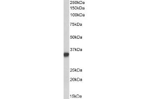 ABIN2613403 (0. (CD74 Antikörper  (Internal Region))
