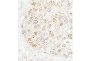Immunohistochemistry (IHC) image for anti-Methyl-CpG Binding Domain Protein 4 (MBD4) (AA 1-50) antibody (ABIN7453727)