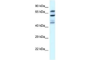 Western Blot showing EIF2B5 antibody used at a concentration of 1 ug/ml against U937 Cell Lysate