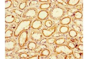 Immunohistochemistry of paraffin-embedded human kidney tissue using ABIN7151711 at dilution of 1:100 (LACTB2 Antikörper  (AA 6-288))