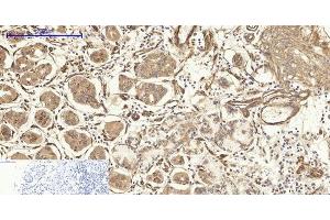 Immunohistochemistry of paraffin-embedded Human stomach tissue using CAV1 Polyclonal Antibody at dilution of 1:200. (Caveolin-1 Antikörper)