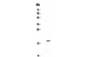 Western blot analysis of IL32 using anti-IL32 antibody . (IL32 Antikörper  (AA 31-234))