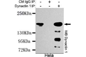 Immunoprecipitation analysis of Hela cell lysates using Dynactin 1 mouse mAb. (Dynactin 1 Antikörper  (N-Term))