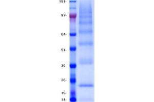 Validation with Western Blot (CD81 Protein (CD81) (Myc-DYKDDDDK Tag))