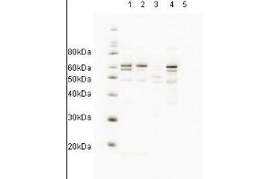 Western blot showing anti-HR23A antibody detects endogenous human HR23A. (RAD23A Antikörper  (AA 122-135))