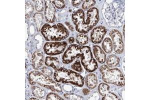 Immunohistochemical staining of human kidney with ZNF519 polyclonal antibody  shows strong cytoplasmic positivity in cells in tubules. (ZNF519 Antikörper)