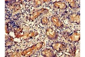 Immunohistochemistry of paraffin-embedded human small intestine tissue using ABIN7174662 at dilution of 1:100 (UAP1 Antikörper  (AA 1-522))