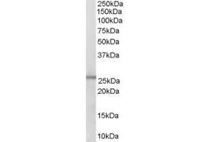 Western Blotting (WB) image for anti-Acyl-CoA Synthetase Medium-Chain Family Member 2A (ACSM2A) (Middle Region) antibody (ABIN2156342) (ACSM2A Antikörper  (Middle Region))