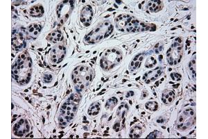 Immunohistochemical staining of paraffin-embedded breast tissue using anti-MAPK1 mouse monoclonal antibody. (ERK2 Antikörper)