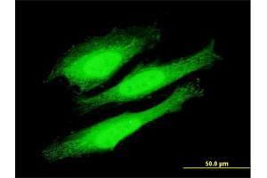 Immunofluorescence (IF) image for anti-Cell Cycle and Apoptosis Regulator 2 (CCAR2) (AA 1-923) antibody (ABIN528320)