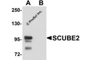 Western Blotting (WB) image for anti-Signal Peptide, CUB Domain, EGF-Like 2 (SCUBE2) (Middle Region) antibody (ABIN1031083) (SCUBE2 Antikörper  (Middle Region))