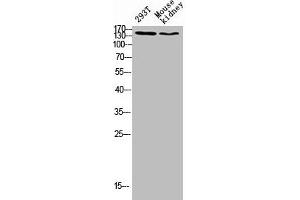 Western blot analysis of 293T lysate, mouse kidney antibody was diluted at 500. (FLT4 Antikörper  (AA 640-700))
