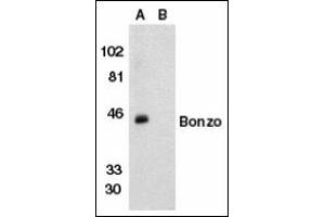 Image no. 2 for anti-Chemokine (C-X-C Motif) Receptor 6 (CXCR6) antibody (ABIN372833) (CXCR6 Antikörper)