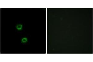 Immunofluorescence analysis of MCF7 cells, using TMEM30C Antibody. (TMEM30C Antikörper  (AA 51-100))